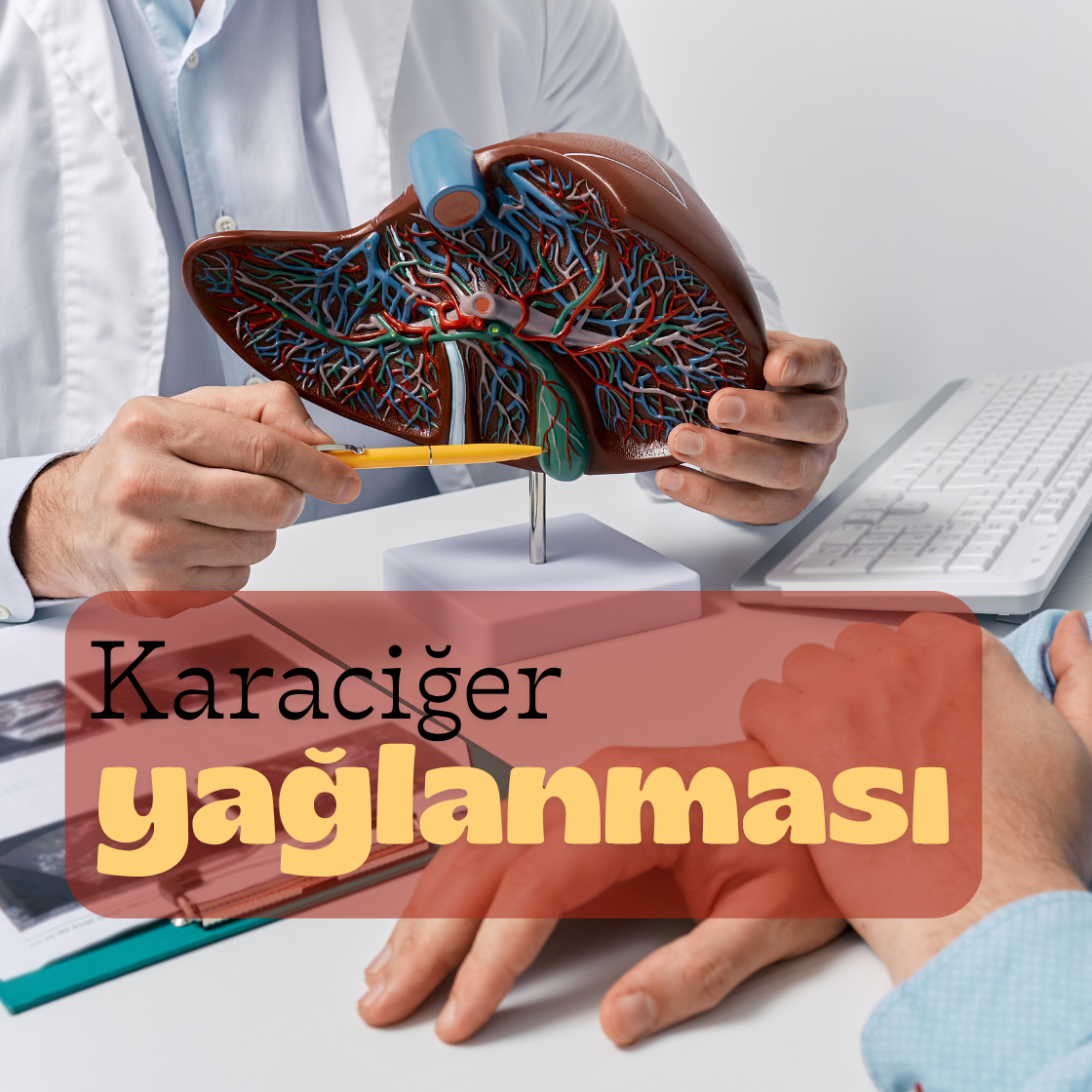 Karaciğer Detoksu Nedir? Yağlı Karaciğerin Belirtileri, Nedenleri ve Doğal Tedavi Yöntemleri